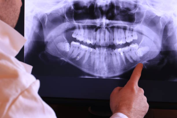 Best Emergency Root Canal Treatment in Stanhope, NJ