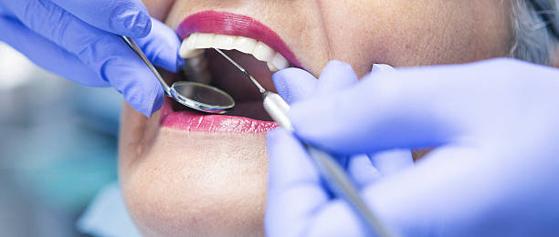 Best Urgent Care for Lost Fillings or Crowns in Stanhope, NJ